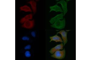 ABIN6257892 and ABIN6274756 staining Hela cells by IF/ICC. (RPS4X Antikörper  (Internal Region))