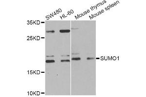 Western blot analysis of extracts of various cell lines, using SUMO1 Antibody (ABIN5971157) at 1/1000 dilution.