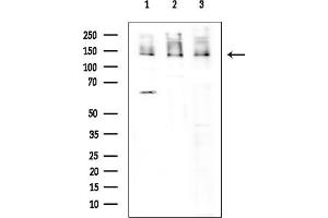 Western blot analysis of lysates from various samples, using  Antibody at 1/1000 dilution. (DDB1 Antikörper  (C-Term))