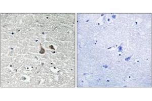 Immunohistochemistry analysis of paraffin-embedded human brain, using IRAK1 (Phospho-Ser376) Antibody. (IRAK1 Antikörper  (pSer376))