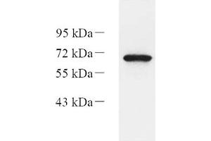 Western blot analysis of Eif2ak1 (ABIN7073875) at dilution of 1: 1000,Lane 1: HEK293 cell lysate (EIF2AK1 Antikörper)