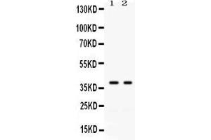 Western blot analysis of GAL4 expression in SW620 whole cell lysates ( Lane 1) and COLO320 whole cell lysates ( Lane 2). (GAL4 Antikörper  (C-Term))