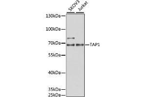 Western blot analysis of extracts of various cell lines, using T antibody (ABIN6131162, ABIN6148845, ABIN6148846 and ABIN6221804) at 1:1000 dilution. (TAP1 Antikörper  (AA 524-808))