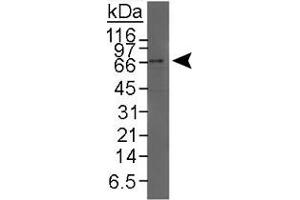 Western blot analysis of NR1H4 in HeLa nuclear extract using NR1H4 polyclonal antibody . (NR1H4 Antikörper  (C-Term))