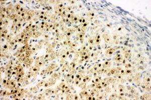 Anti-MTA1 antibody, IHC(F) IHC(F): Rat Ovary Tissue