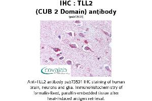 Image no. 1 for anti-Tolloid-Like 2 (TLL2) antibody (ABIN1740102) (Tolloid-Like 2 Antikörper)