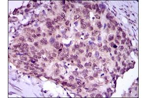 Flow cytometric analysis of HeLa cells using MEF2C antibody (green) and negative control (purple).