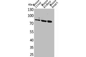 Western Blot analysis of mouse liver mouse kidney mouse heart cells using CUL-4B Polyclonal Antibody (Cullin 4B Antikörper  (Internal Region))