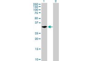 Western Blot analysis of LYPD5 expression in transfected 293T cell line by LYPD5 MaxPab polyclonal antibody. (LYPD5 Antikörper  (AA 1-249))