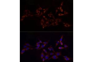 Immunofluorescence analysis of PC-12 cells using RPL10A Rabbit mAb (ABIN7269992) at dilution of 1:100 (40x lens).
