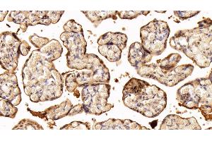 Immunohistochemistry (IHC) image for anti-Transglutaminase 2 (C Polypeptide, Protein-Glutamine-gamma-Glutamyltransferase) (TGM2) (AA 1-687) antibody (ABIN7434158)