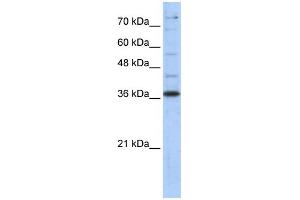 WB Suggested Anti-GAPDH Antibody Titration:  0. (GAPDH Antikörper  (Middle Region))
