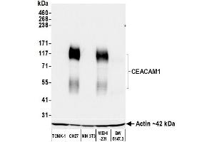 Western Blotting (WB) image for anti-Carcinoembryonic Antigen-Related Cell Adhesion Molecule 1 (CEACAM1) (AA 35-141) antibody (ABIN7455130)