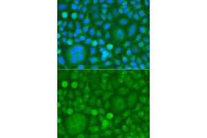 Immunofluorescence analysis of HeLa cells using EPM2A antibody (ABIN5974214). (EPM2A Antikörper)