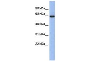 Image no. 1 for anti-Calcium Channel, Voltage-Dependent, beta 2 Subunit (CACNB2) (AA 431-480) antibody (ABIN6742590) (CACNB2 Antikörper  (AA 431-480))