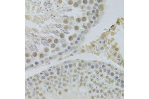 Immunohistochemistry of paraffin-embedded rat testis using HDGF Antibody. (HDGF Antikörper  (AA 1-240))