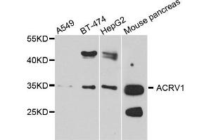 Western blot analysis of extract of various cells, using ACRV1 antibody. (ACRV1 Antikörper)