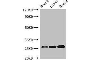 Western Blot Positive WB detected in: Mouse heart tissue, Mouse liver tissue, Mouse brain tissue All lanes: RND2 antibody at 2 μg/mL Secondary Goat polyclonal to rabbit IgG at 1/50000 dilution Predicted band size: 26 kDa Observed band size: 26 kDa (RND2 Antikörper  (AA 104-163))
