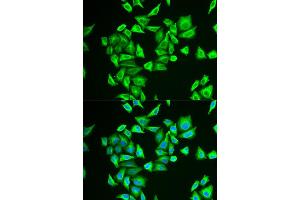 Immunofluorescence (IF) image for anti-Phosphoglucomutase 1 (PGM1) antibody (ABIN1980319)