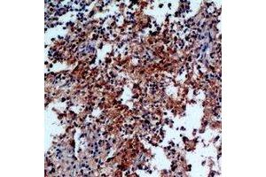 Immunohistochemical analysis of IL-31 staining in human spleen formalin fixed paraffin embedded tissue section. (IL-31 Antikörper)
