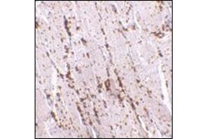 Immunohistochemistry of LIMP2 in human skeletal muscle with this product at 2. (SCARB2 Antikörper  (Center))