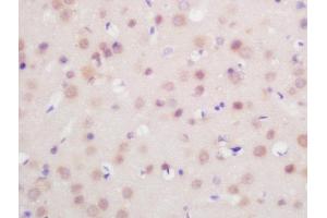 Formalin-fixed and paraffin embedded mouse brain labeled with Rabbit Anti-FoxP1 Polyclonal Antibody, Unconjugated  at 1:200 followed by conjugation to the secondary antibody and DAB staining (FOXP1 Antikörper  (AA 581-705))
