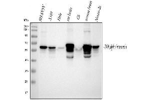 Western blot analysis of Alpha Internexin using anti-Alpha Internexin antibody (ABIN4886634). (INA Antikörper  (AA 71-161))