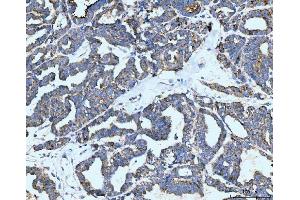 IHC analysis of Neurofibromin/NF1 using anti-Neurofibromin/NF1 antibody (ABIN7600197). (Neurofibromin 1 Antikörper  (AA 160-270))