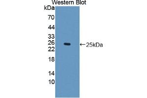 Western blot analysis of the recombinant protein. (IFNE Antikörper  (AA 30-208))