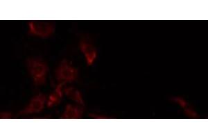 ABIN6277840 staining Hela by IF/ICC. (CD22 Antikörper)