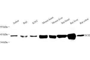 Western blot analysis of ECI2 (ABIN7073837) at dilution of 1: 500 (PECI/ECI2 Antikörper)
