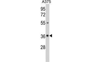 Western blot analysis of GALE Antibody (Center) in A375 cell line lysates (35 µg/lane). (GALE Antikörper  (Middle Region))