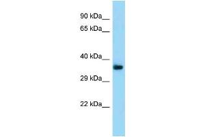 Western Blotting (WB) image for anti-Transmembrane Protein 164 (TMEM164) (N-Term) antibody (ABIN2788478) (TMEM164 Antikörper  (N-Term))