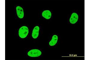 Immunofluorescence of monoclonal antibody to SMAD3 on HeLa cell. (SMAD3 Antikörper  (AA 147-270))