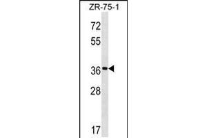 Western blot analysis in ZR-75-1 cell line lysates (35ug/lane). (FUT7 Antikörper  (N-Term))