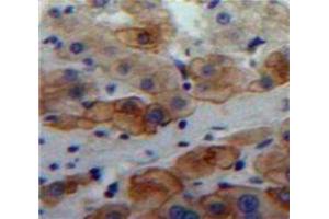 Used in DAB staining on fromalin fixed paraffin-embedded Liver tissue (LAMa4 Antikörper  (AA 832-1039))