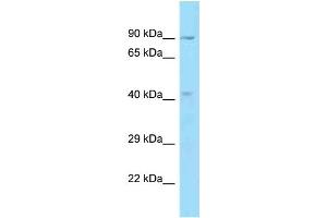 WB Suggested Anti-OBFC1 Antibody Titration: 1. (OBFC1 Antikörper  (C-Term))