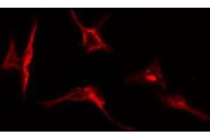 ABIN6277063 staining  HepG2 cells by IF/ICC. (FGFR1 Antikörper  (C-Term))