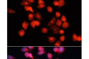 Immunofluorescence analysis of HeLa cells using SLC25A5 Polyclonal Antibody at dilution of 1:100 (40x lens). (SLC25A5 Antikörper)