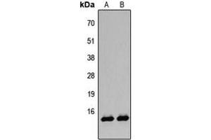 Western blot analysis of Histone H2B (AcK12) expression in A431 TSA-treated (A), HeLa TSA-treated (B) whole cell lysates.