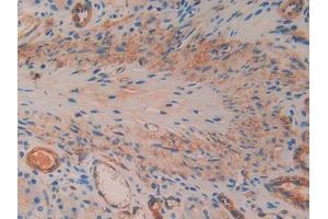 IHC-P analysis of Rat Stomach Tissue, with DAB staining. (SMAD1 Antikörper  (AA 273-468))