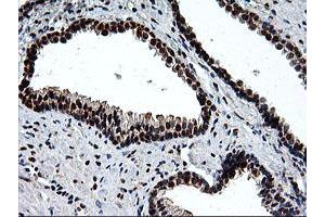 Image no. 1 for anti-EPM2A (Laforin) Interacting Protein 1 (EPM2AIP1) antibody (ABIN1498046) (EPM2AIP1 Antikörper)