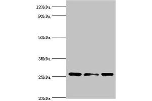 Western blot All lanes: Chloride intracellular channel protein 1 antibody at 4 μg/mL Lane 1: Hela whole cell lysate Lane 2: Jurkat whole cell lysate Lane 3: MCF-7 whole cell lysate Secondary Goat polyclonal to rabbit IgG at 1/10000 dilution Predicted band size: 27 kDa Observed band size: 27 kDa (CLIC1 Antikörper  (AA 42-241))
