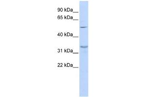 WB Suggested Anti-ZNF765 Antibody Titration:  0. (ZNF765 Antikörper  (Middle Region))