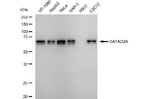 Western blotting analysis using GATAD2A antibody (ABIN7798698). (Rekombinanter GATAD2A Antikörper)