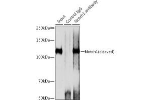 Immunoprecipitation analysis of 200 μg extracts of 293T cells using 3 μg Notch1 antibody (ABIN7268958).