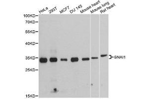 Western blot analysis of extracts of various cell lines, using SNAI1 antibody.
