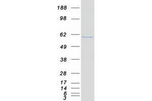Validation with Western Blot