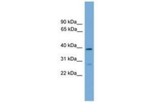 Image no. 1 for anti-Neutrophil Cytosolic Factor 4, 40kDa (NCF4) (AA 267-316) antibody (ABIN6745519)