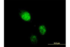 Immunofluorescence of purified MaxPab antibody to RAD23B on HeLa cell. (RAD23B Antikörper  (AA 1-409))